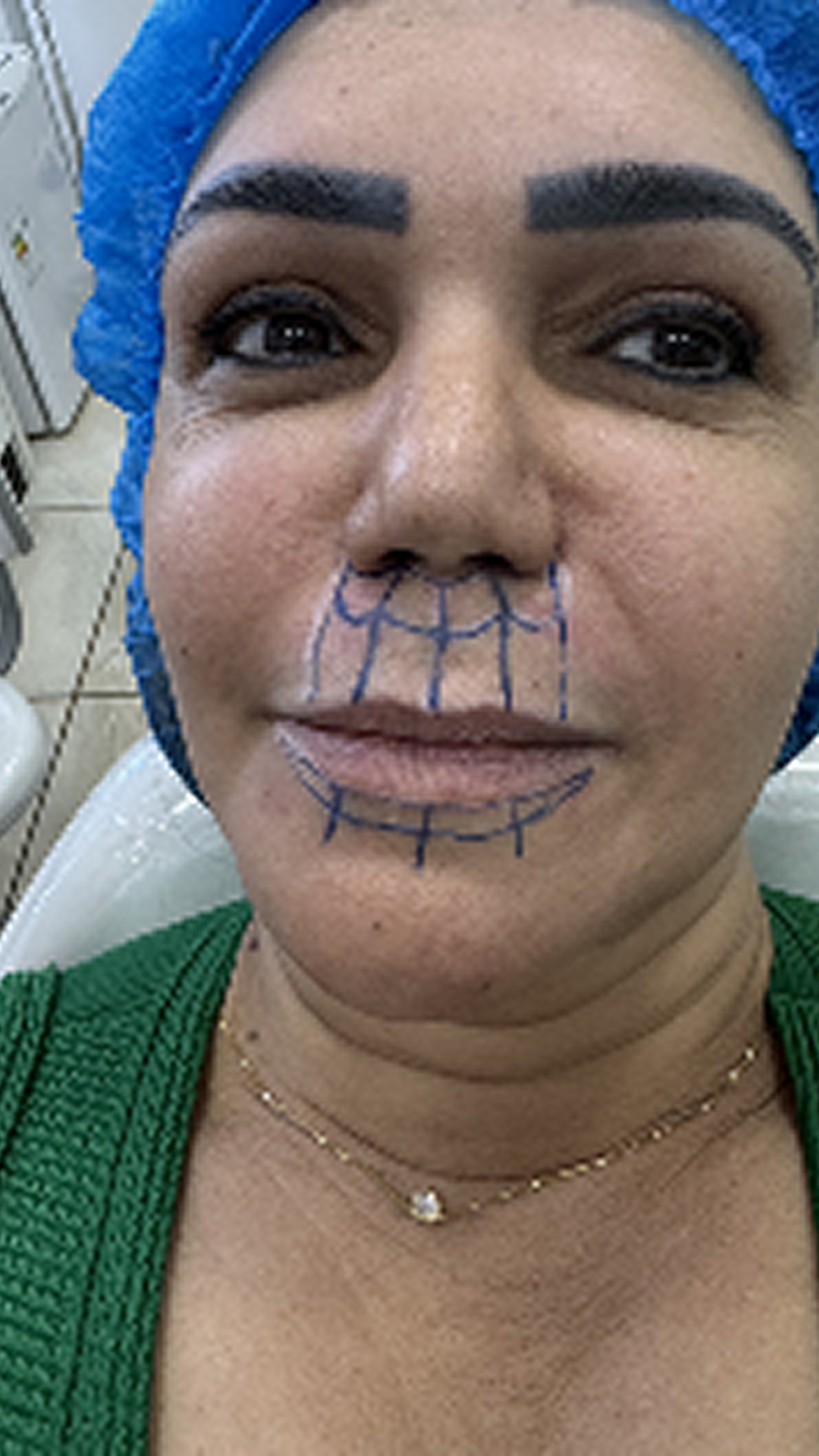 PROVA SOCIAL 5